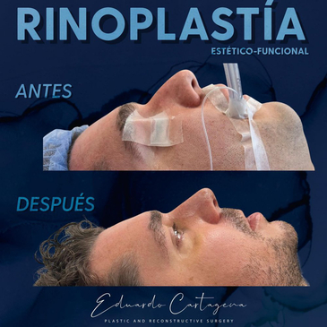 Slider image (7) Dr. Eduardo Cartagena - Plastic Surgeon in Mexico City